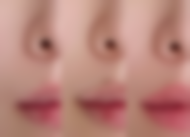 玻尿酸填充脸部的收费价格是多少？