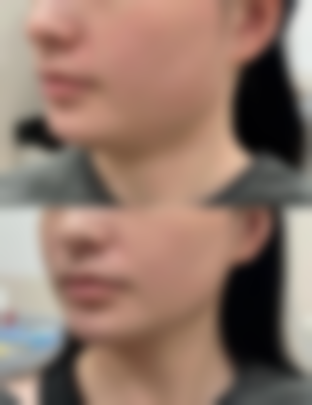 乔雅登雅致填充泪沟有哪些真实实例？