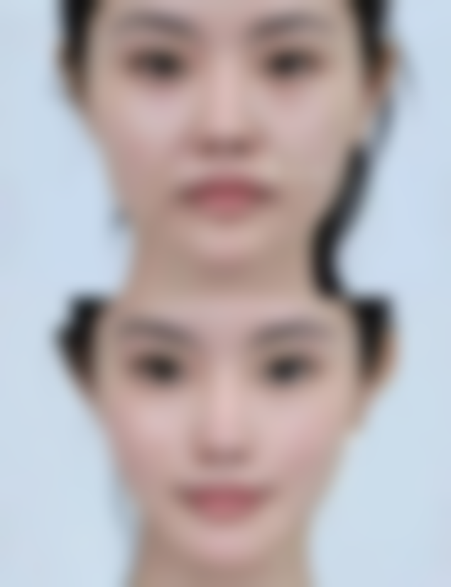 乔雅登雅致和极致填充泪沟有什么区别？