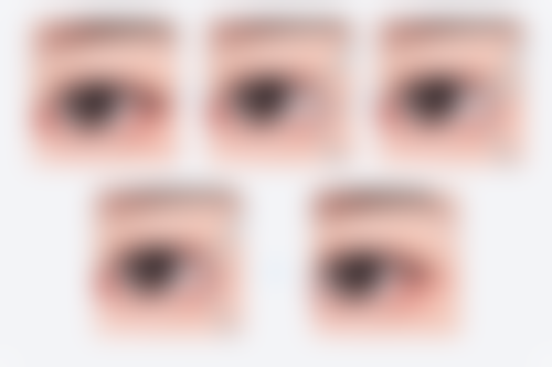 二、切开双眼皮通常在什么阶段被纳入医疗选择范围？