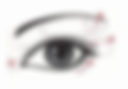 双眼皮手术是什么？在什么情况下会被选择？