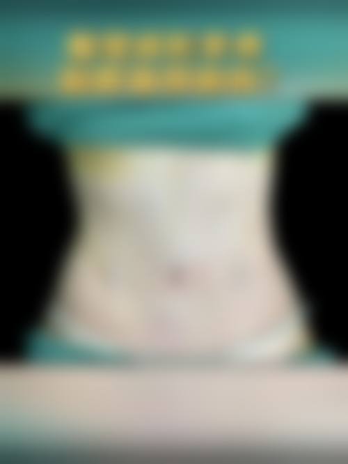 抽脂可以永久的吗？可以！脂肪数量恒定原理揭秘，术后饮食运动防反弹更持久