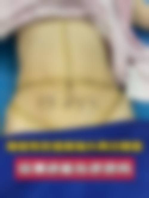 为什么抽脂维持时间结论会存在差异