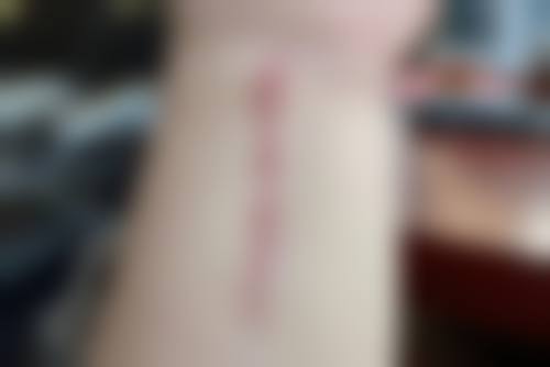 哪些情况通常不被认为是合适指征？