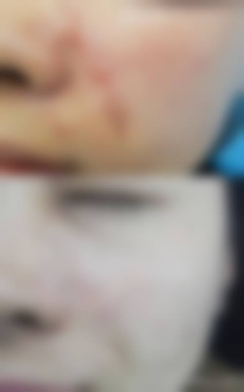 版纳美业医疗美容诊所特色项目及技术优势