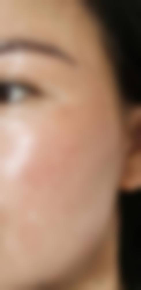 湘潭华美医疗美容特色项目：