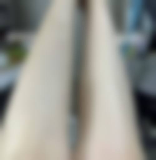 黄晋医生擅长哪些项目