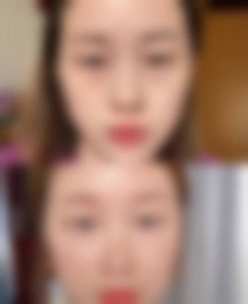 按摩消除眼袋的常见认知偏差与误解