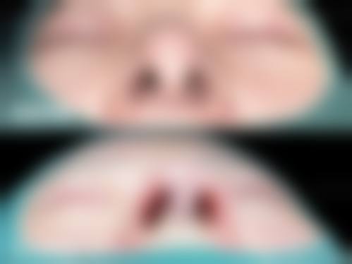 银川微茉王东海医生擅长项目