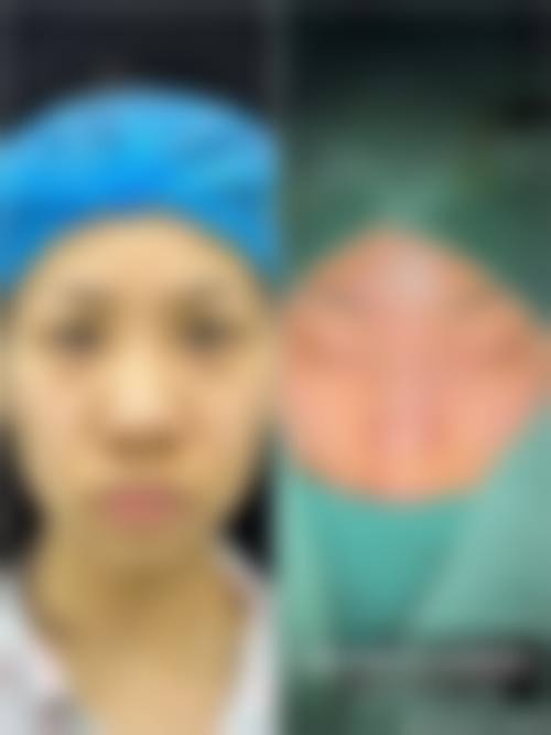 银川微茉王东海医生预约挂号