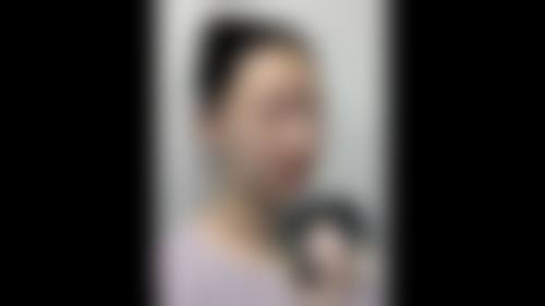 面部吸脂手术恢复期多久？一般1 - 3个月基本恢复，3 - 6个月完全恢复！术后多久消肿及注意事项揭秘 