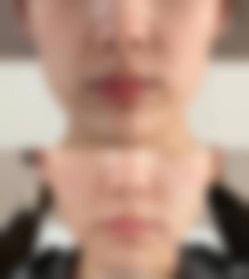 上饶德尔美客医疗美容门诊部是正规医院吗？