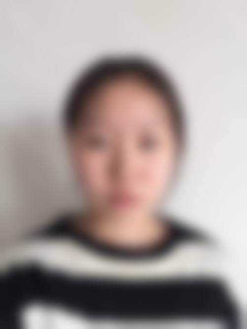 湘潭华美医疗美容收费价格表：