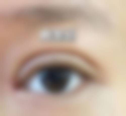 为什么用眼膜去眼袋的前后对比差异会非常明显