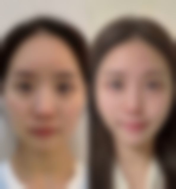 湘潭华美医疗美容口碑如何？