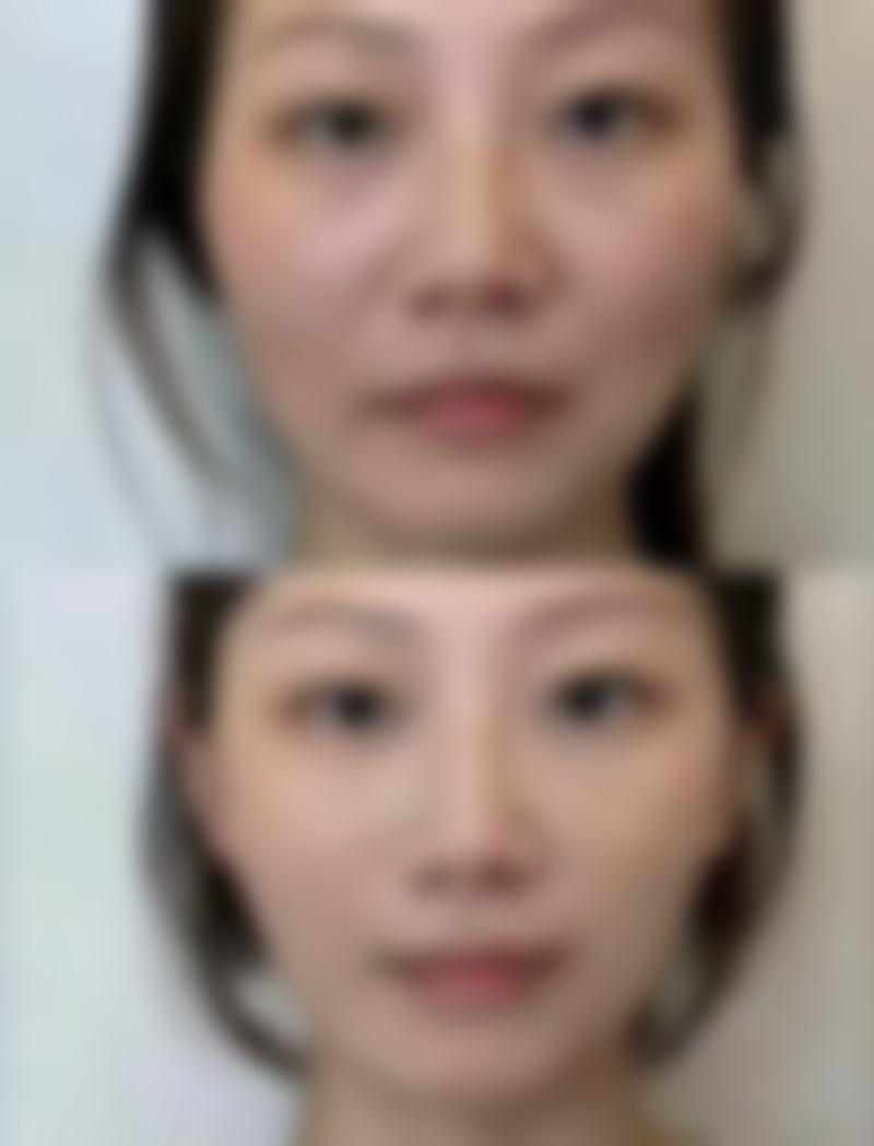 银川微茉王东海医生口碑评价及反馈内容