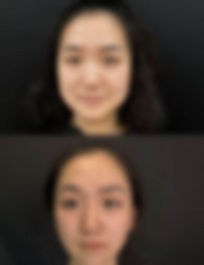 银川微茉王东海医生技术水平高