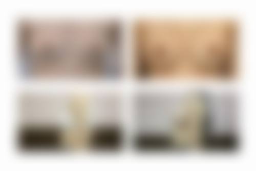 为什么做过假体隆胸后定期复诊特别重要？