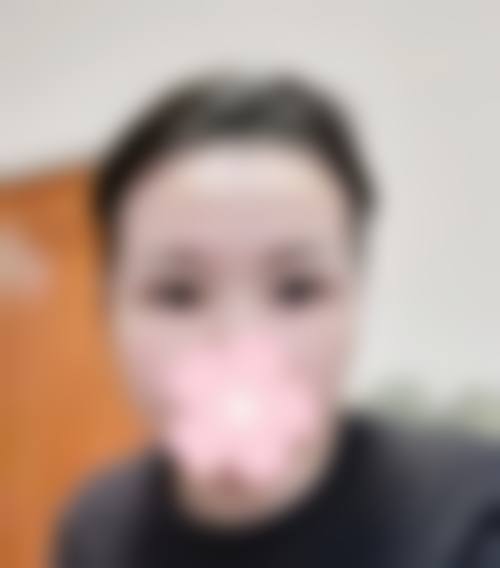 双眼皮手术8天拆线价格区间及费用差异来源