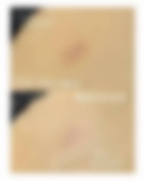 丽江美柏瑞医疗美容医院收费价格表：