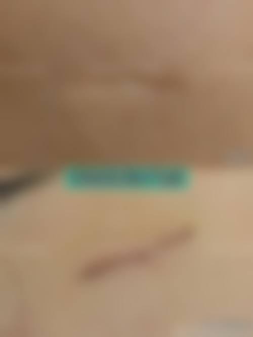 淡化疤痕留下的黑色素的注意事项，治疗前后都要重视