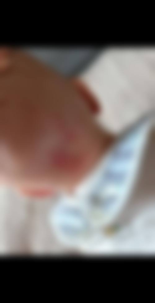 二、南昌华瑞出色医疗美容医院重点开展项目