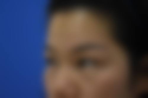 激光去眼袋和手术去眼袋哪个好