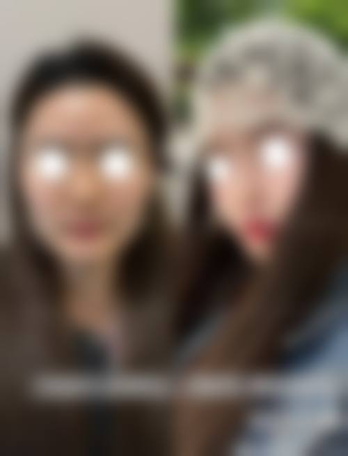 半肋骨隆鼻手术过程是怎样的？