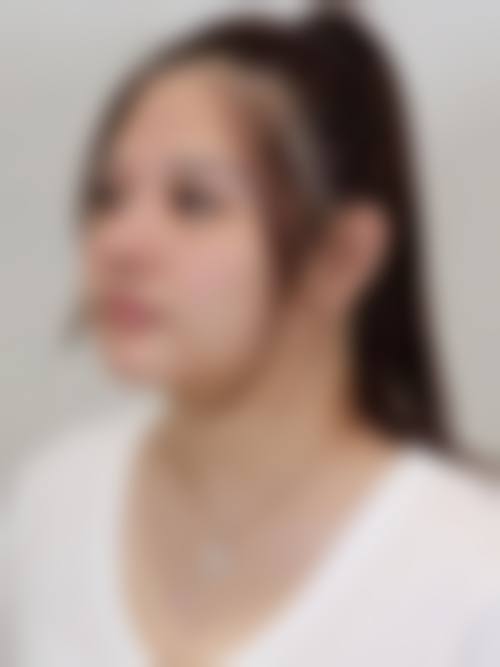 三、广州华美整形美容医院核心技术与诊疗优势