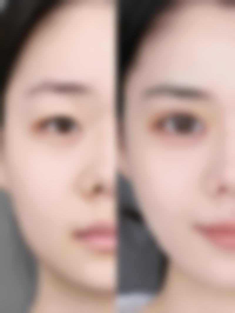 哪些使用场景下割双眼皮的成效往往不理想