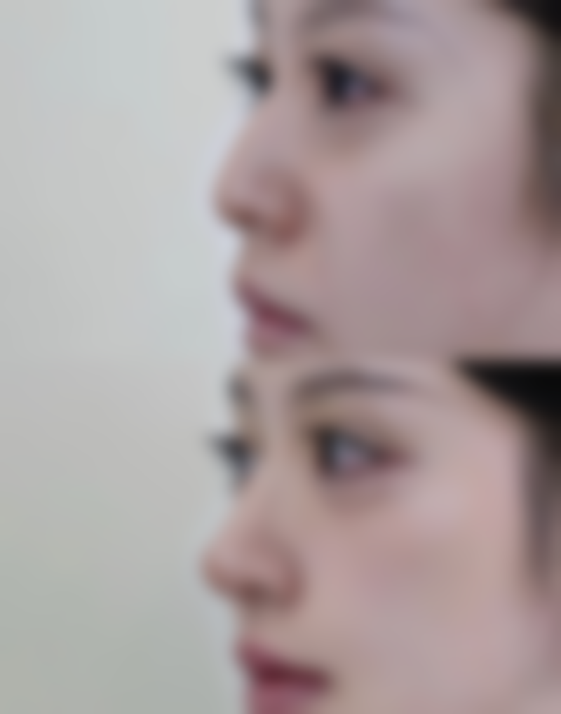 八、韩国WIZ&美整形价格表