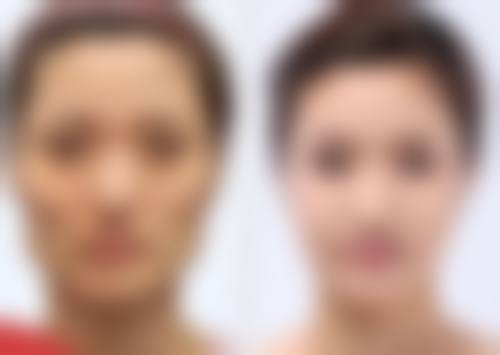 头发种植价格区间及费用差异来源