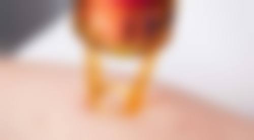 头发种植常见并发症或后遗症，真实发生概率如何？