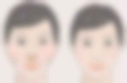 头发种植手术成效能维持多久？