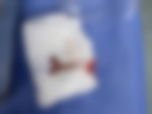 南通星范整形医院特色技术