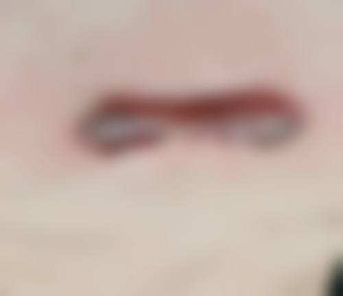 二、邵阳市大祥区小张医疗美容门诊部是正规医院