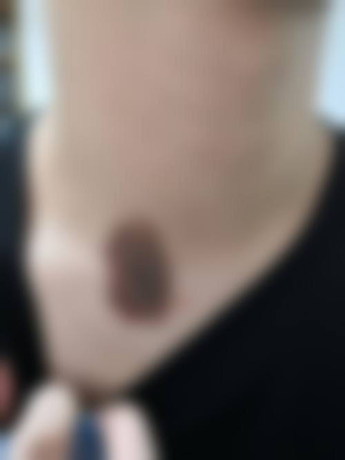 九、衡阳予美（王珍玉）医疗美容诊所口碑与评价