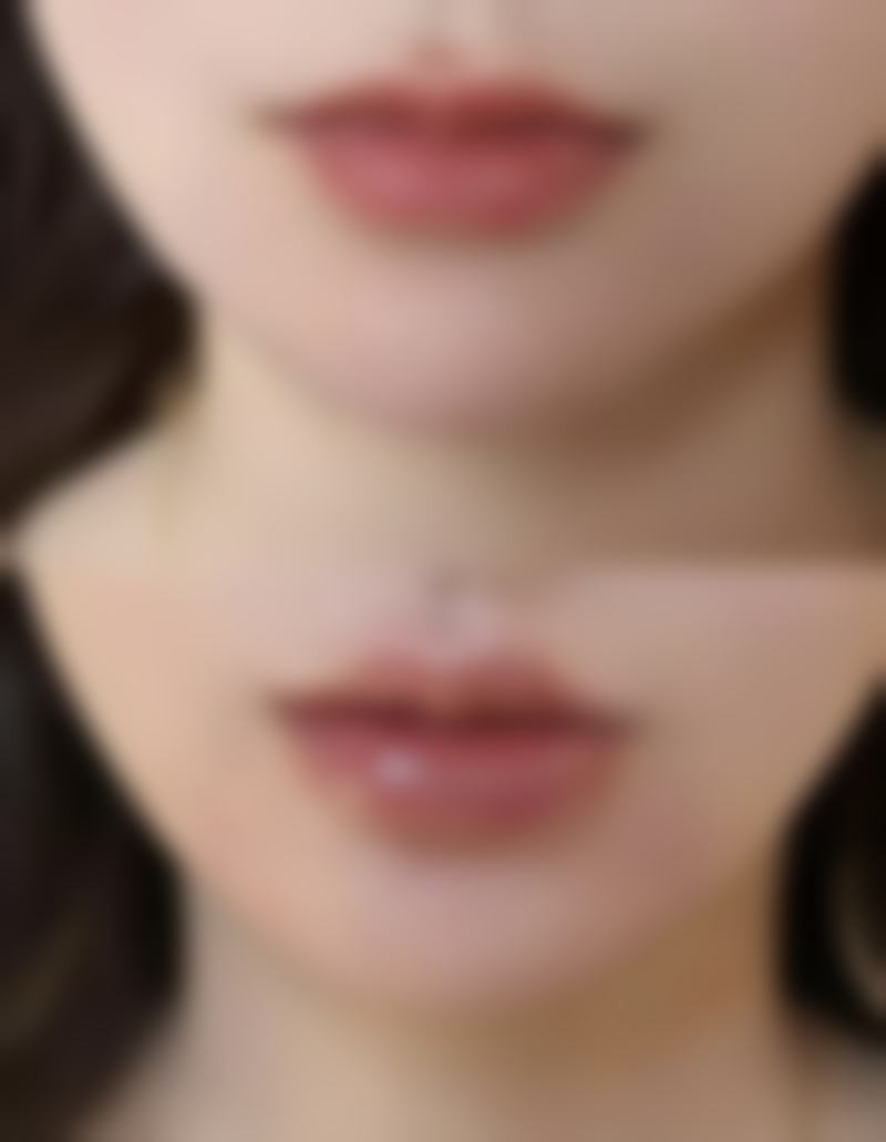 打完瘦脸针后可能出现的其他反应及处理方式