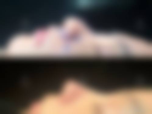 硅胶隆鼻医院与医生选择中，哪些因素更关键？及医院医生推荐！