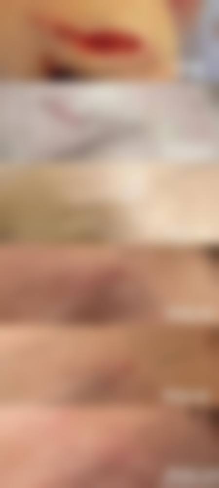 疤痕体质纹唇手术或治疗成效能维持多久？