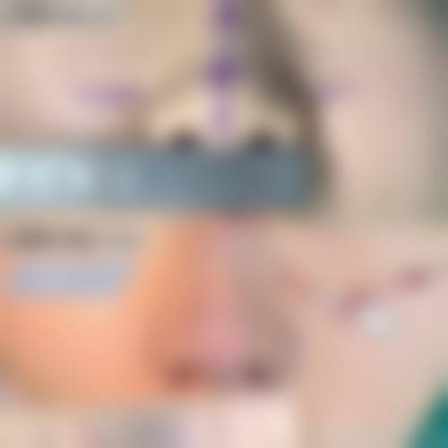 硅胶隆鼻做决定前，普通用户更容易忽略的问题