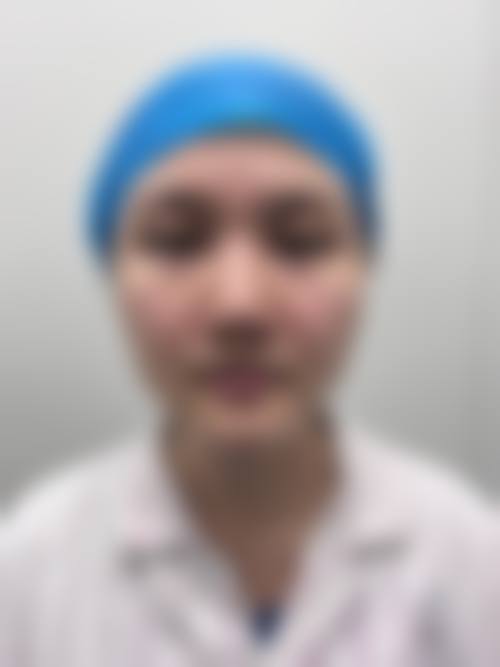 硅胶隆鼻价格3000起且持久的原因