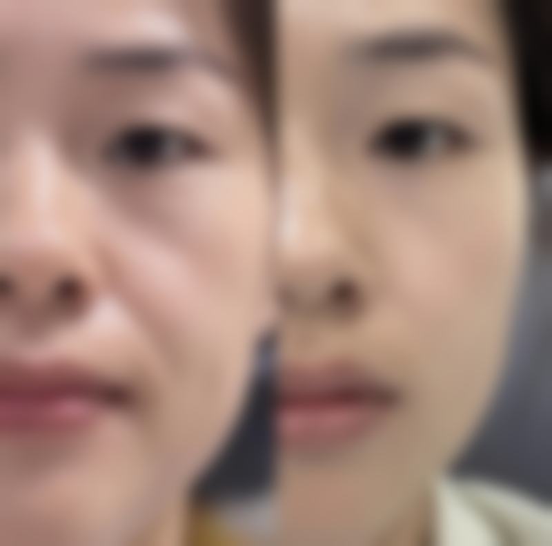 薰衣草精油丰太阳穴的成效稳定性与哪些条件直接相关