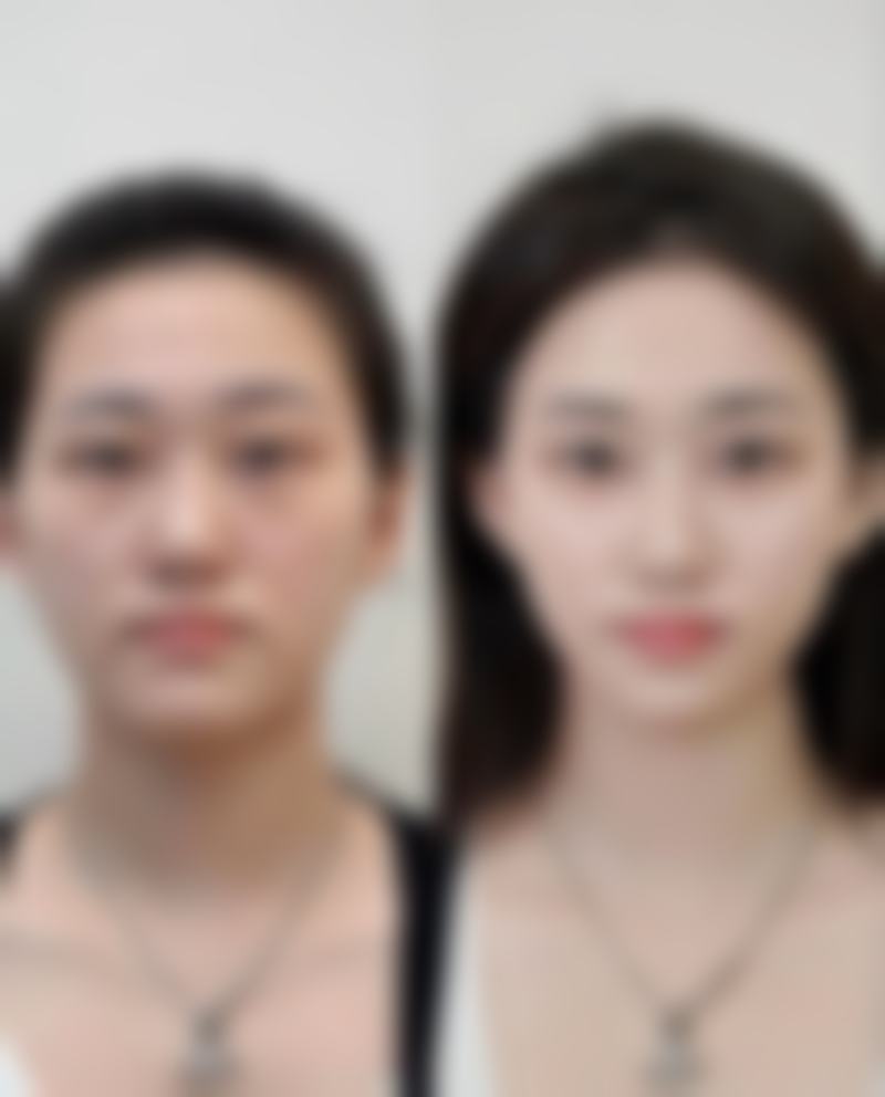 如何为迷迭香精油丰太阳穴 设定一个合理且可验证的成效目标