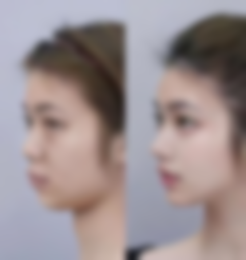 哪些部位或情况使用薰衣草精油丰太阳穴时成效相对更稳定