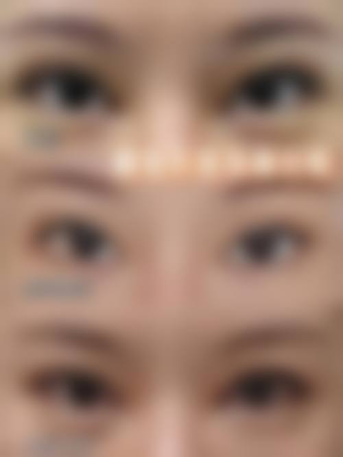 按摩与医美的结合成效分析