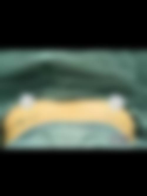 自体脂肪隆胸和假体隆胸成效哪个更持久？假体持久脂肪需多次完善