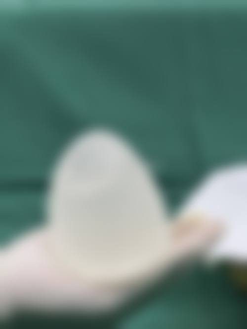 自体脂肪隆胸和假体隆胸哪个安心？各有保护优势不同