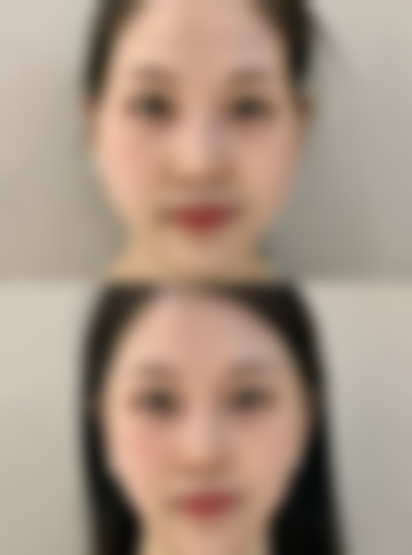 患者常见问题解答（精选 ）