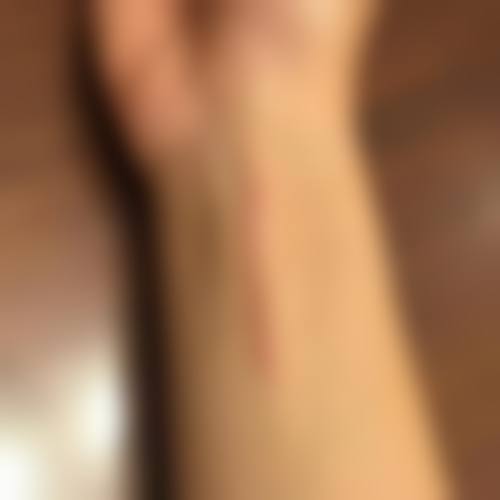 十、患者常见问题解答（精选 ）